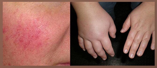 Side effects of points